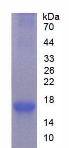 Human DGAT2 Protein (Recombinant His, N-Terminal)