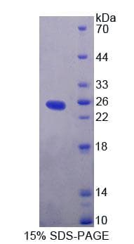Human EXOC3 / SEC6 Protein (Recombinant His-T7, N-terminus)