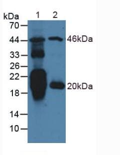 NT-proANP Antibody