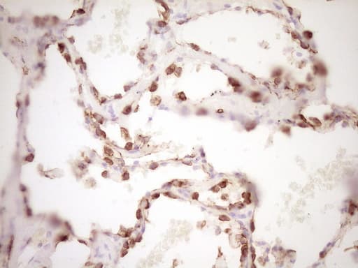 Monoclonal Mouse anti-Human KRT19 / CK19 / Cytokeratin 19 Antibody (clone OTI6A8, aa240-390, IHC, WB)