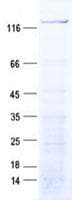 Human MYRIP Protein (Recombinant His, N-Terminal)