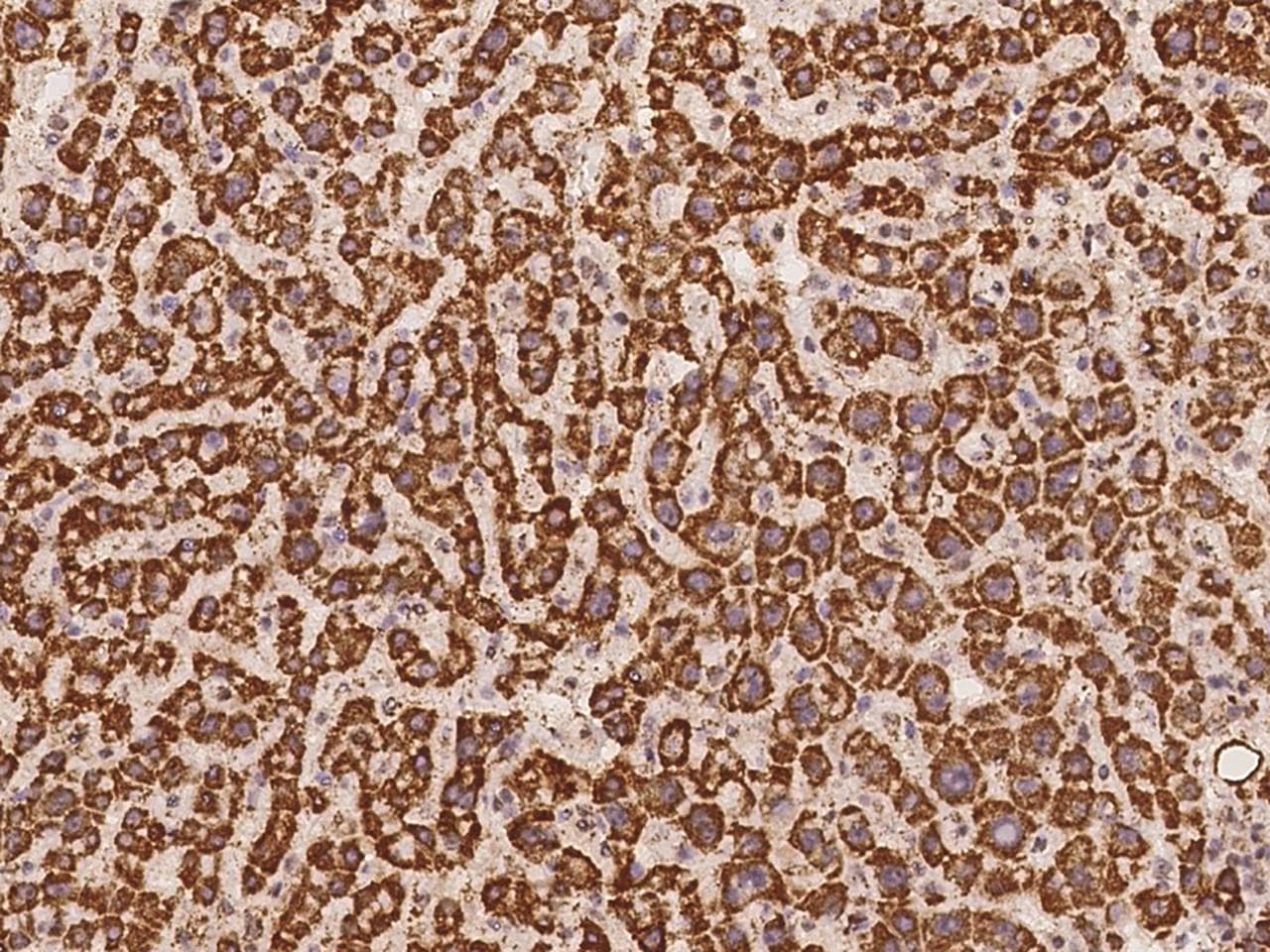 Polyclonal Rabbit anti-Human Gpnat1 / GNPNAT1 Antibody (IHC)