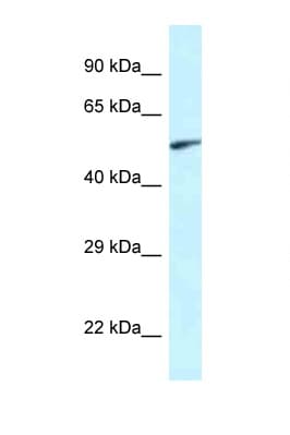 Polyclonal Rabbit anti-Rat EYA2 Antibody (aa200-249, WB)