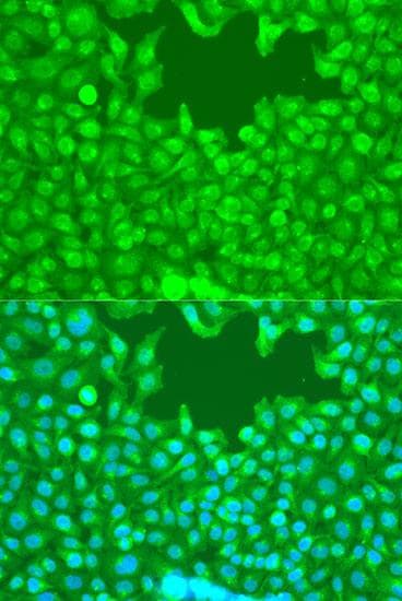 WWTR1 / TAZ Antibody