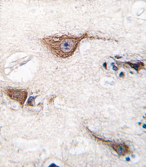 UCHL1 / PGP9.5 Antibody (aa16-46)
