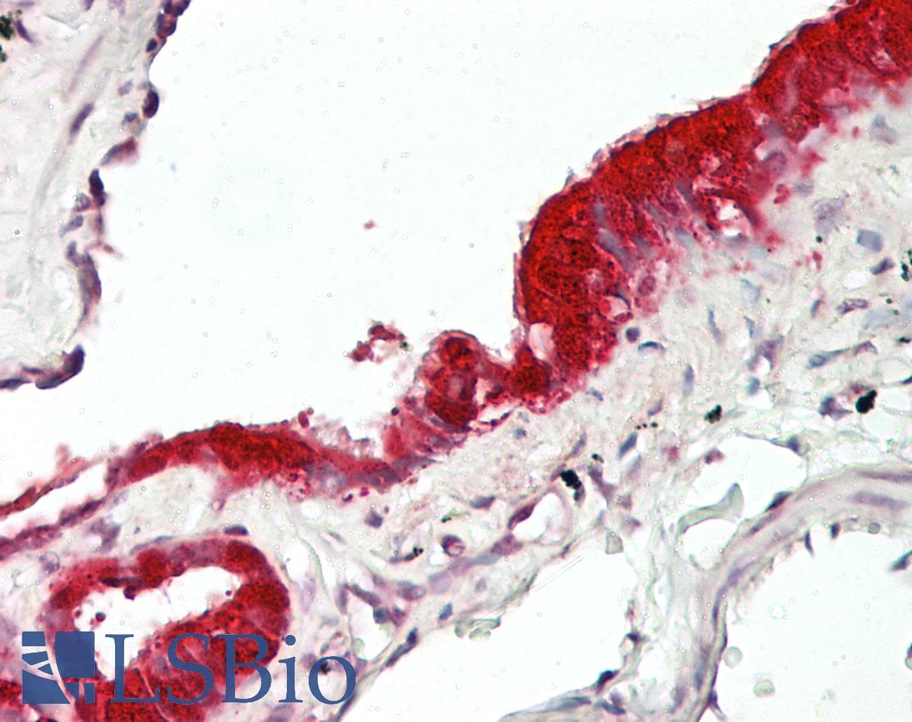 MXI1 / MAD2 Antibody (aa176-225)