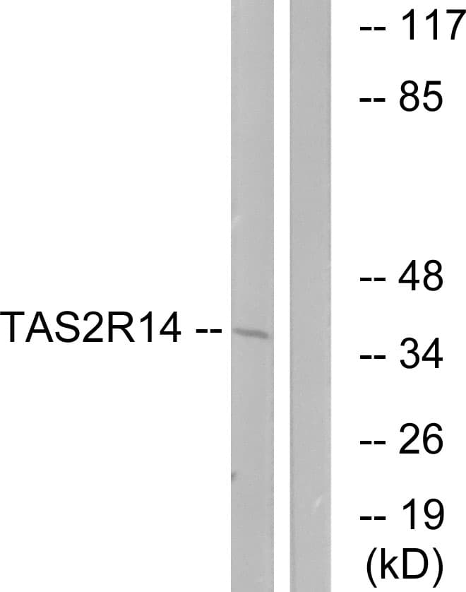 TAS2R14 / TRB1 Antibody (aa229-278)