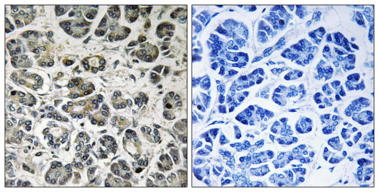 Polyclonal Rabbit anti-Human NDUFA8 Antibody (IHC, WB)