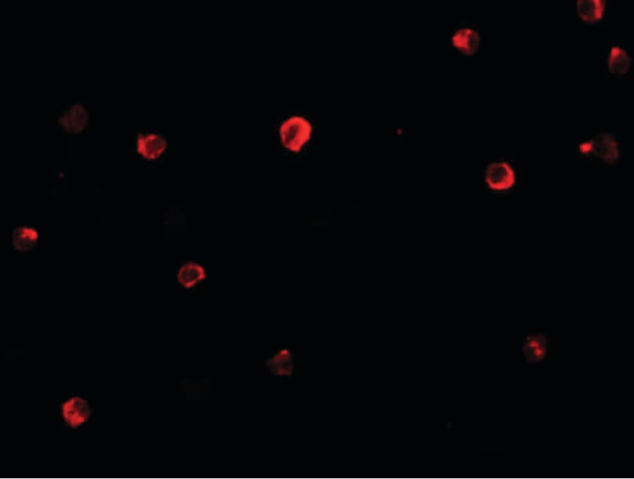 IHC-plus™ Polyclonal Rabbit anti-Human IRF4 Antibody (IHC, IF, WB)