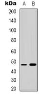 Polyclonal Rabbit anti-Human NCF1 / p47phox / p47 phox Antibody (C-Terminus, IHC, WB)