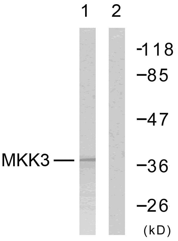 MAP2K3 / MEK3 / MKK3 Antibody (p189)