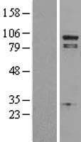 PLA2G4A Protein (Over-Expression Lysate Myc-DDK (Flag))