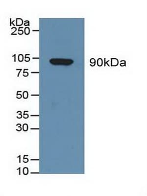 GSN / Gelsolin Antibody (aa674-782)