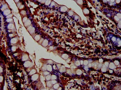 Polyclonal Rabbit anti-Human PTPN3 Antibody (IHC, IF)