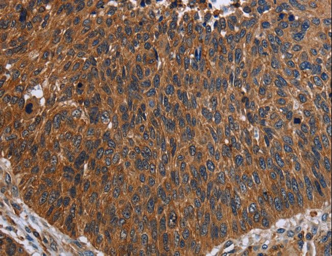 FCGR3A / CD16A Antibody