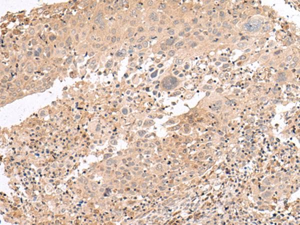 INADL / PATJ Antibody
