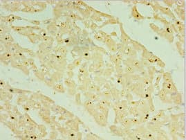 Polyclonal Rabbit anti-Human NKX2-5 Antibody (aa1-135, IHC)