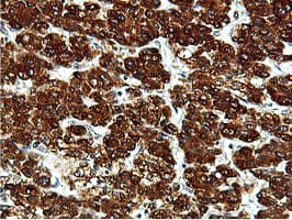 ILVBL Antibody (clone OTI8A12)