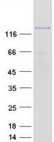 Human AGL Protein (Recombinant Myc-DDK (Flag))