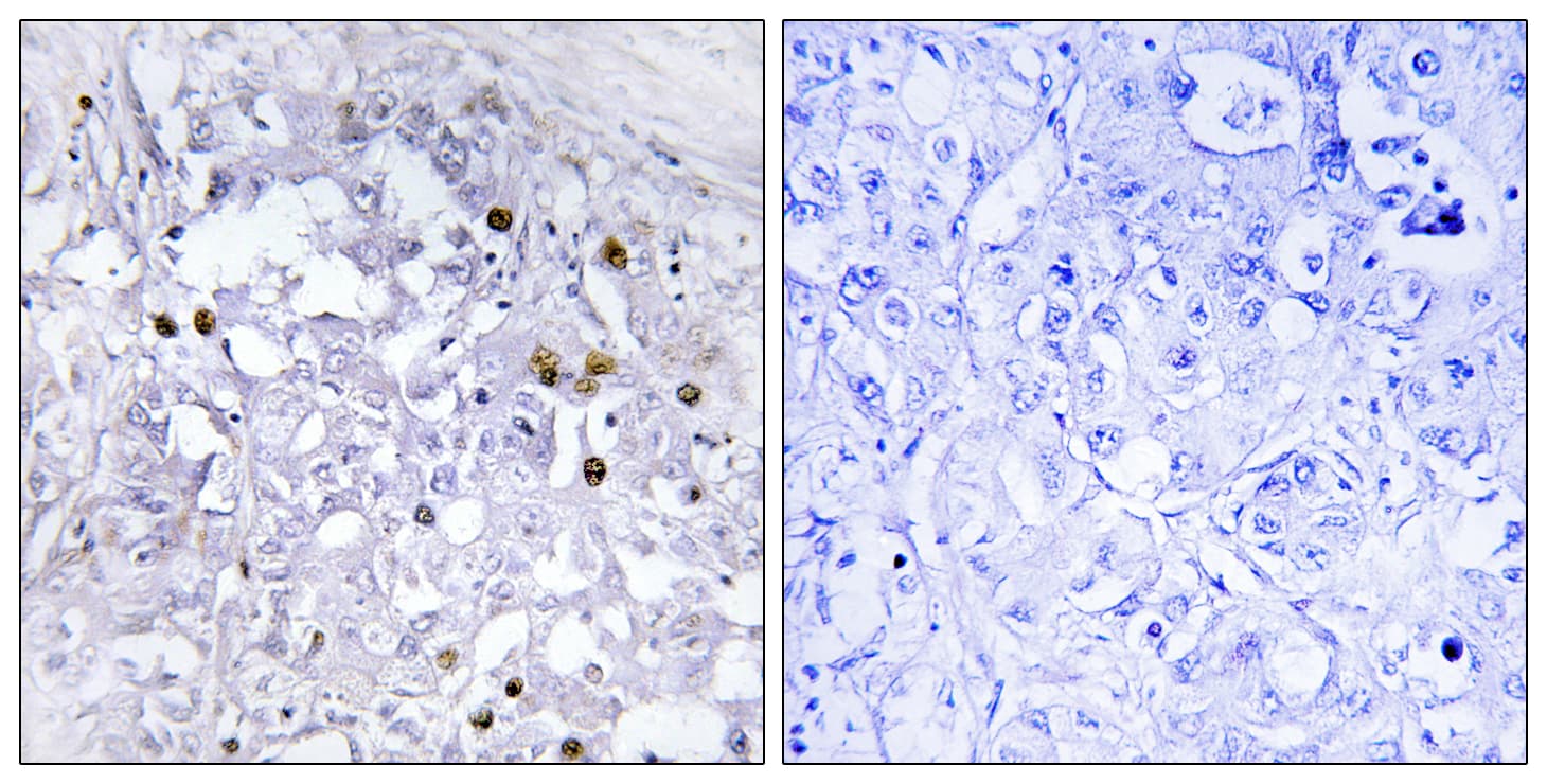 HNF4A / HNF4 Antibody (phospho-Ser313)