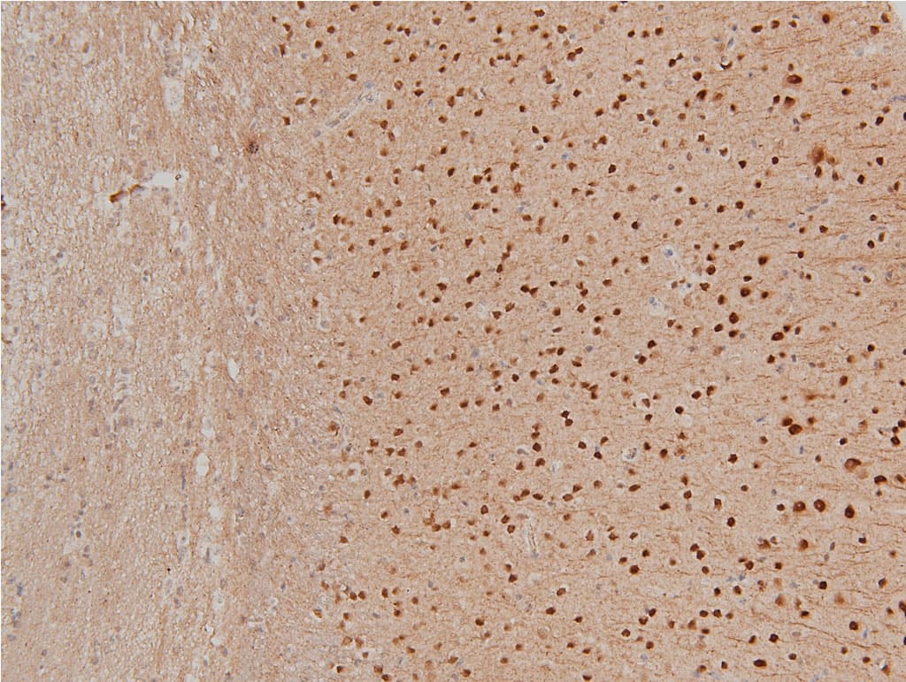 LIMK1 / LIMK Antibody (phospho-Thr508)