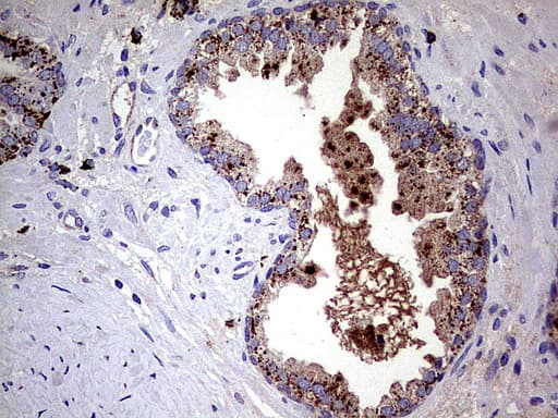 GBA / Glucosidase Beta Acid Antibody (aa40-315, clone UMAB171)