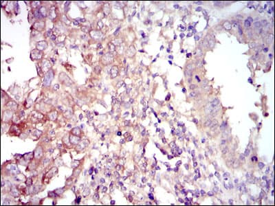FOXO1 / FKHR Antibody (clone 3B6)