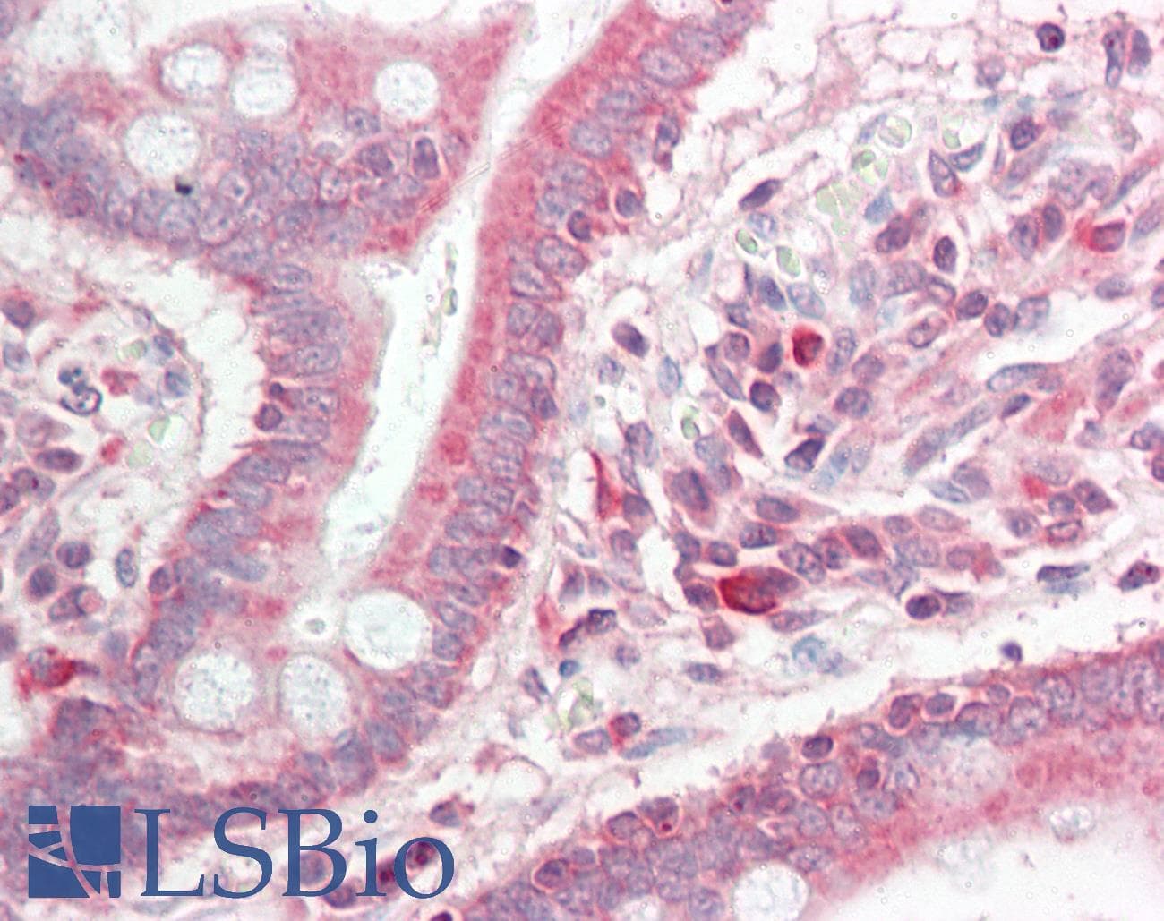 MAPK13 / p38delta Antibody (aa287-336)