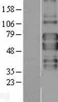 TNFRSF1B / TNFR2 Protein (Over-Expression Lysate Myc-DDK (Flag))