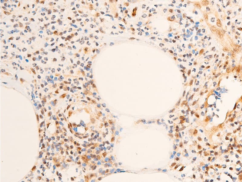 ERBB2 / HER2 Antibody (phospho-Tyr1248)