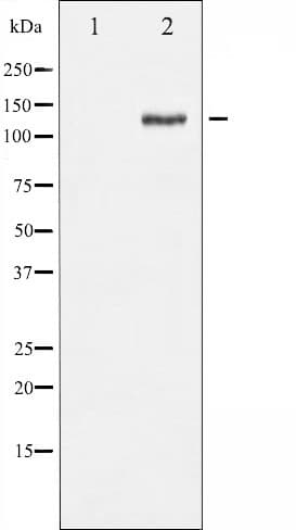 FAK / Focal Adhesion Kinase Antibody (phospho-Ser843)