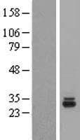 THG1L Protein (Over-Expression Lysate Myc-DDK (Flag))