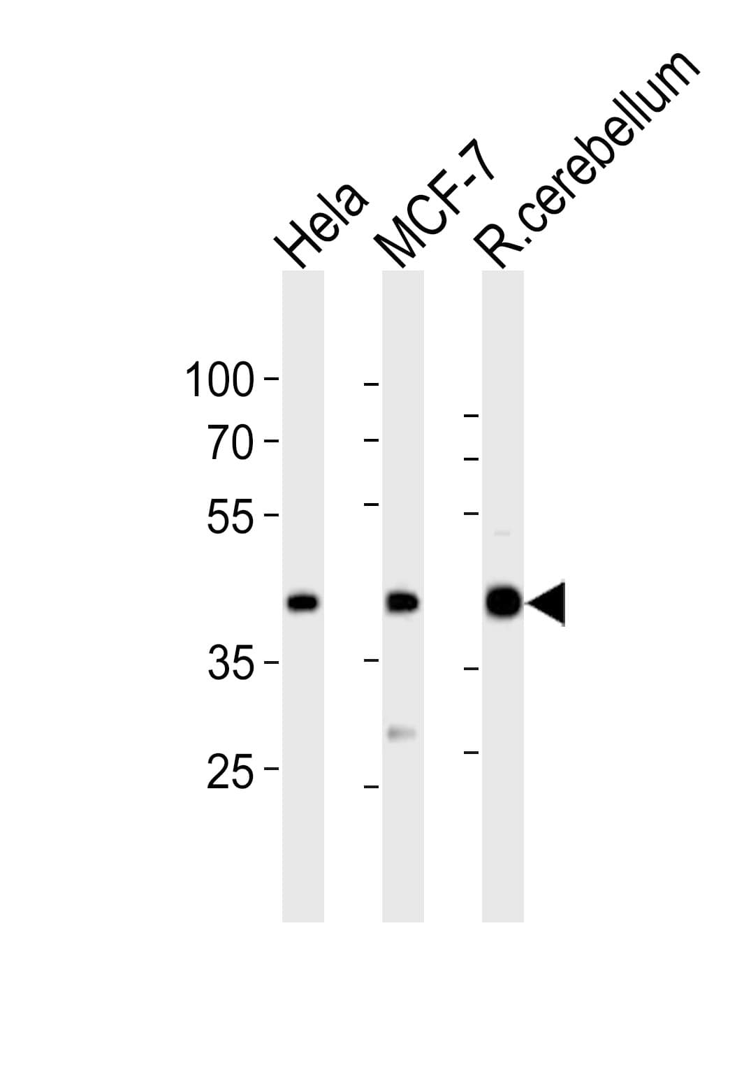 IHC-plus™ LAPTM4B Antibody (aa195-209)
