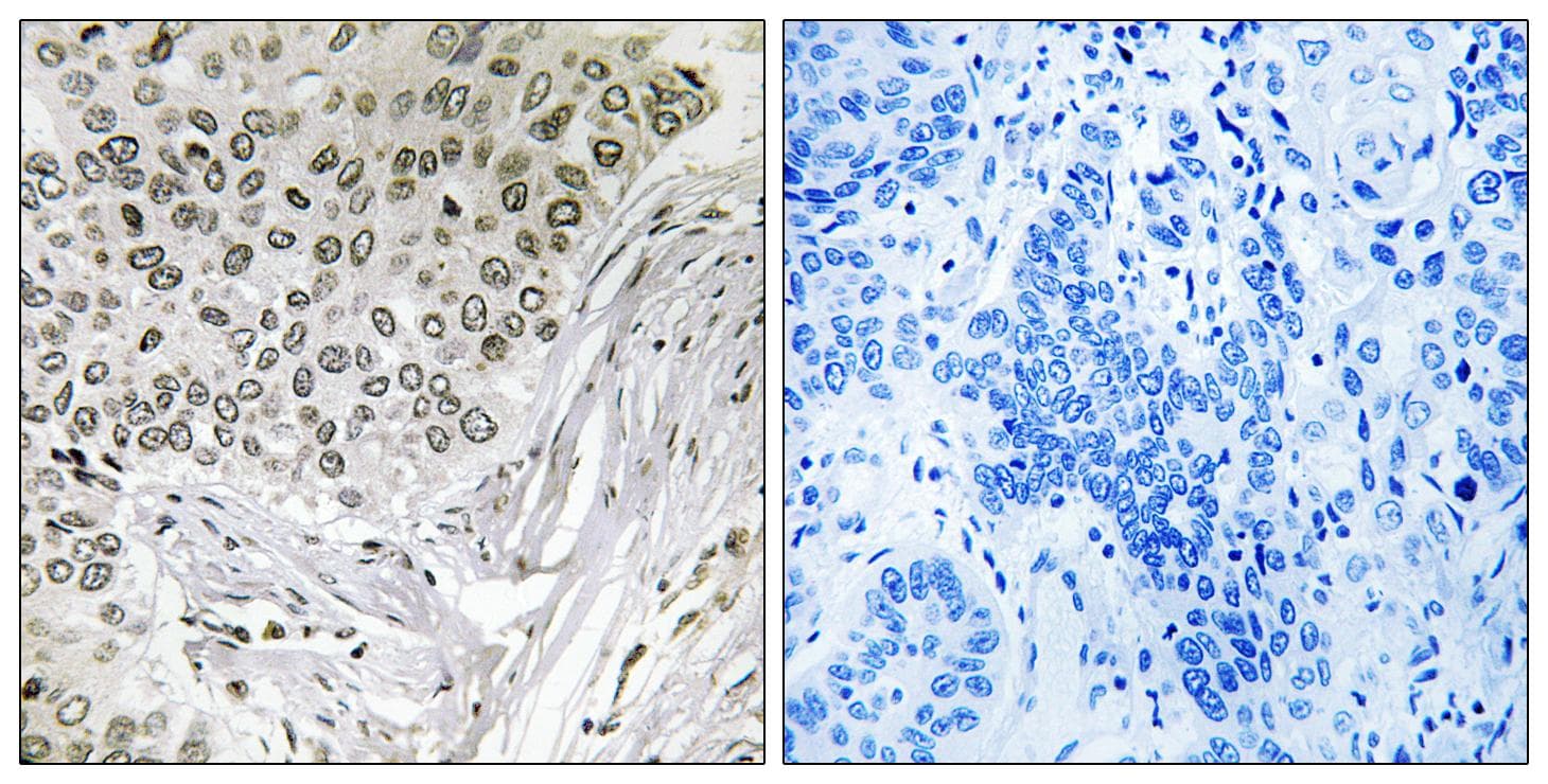 Polyclonal Rabbit anti-Human EFTUD2 Antibody (IHC, WB)