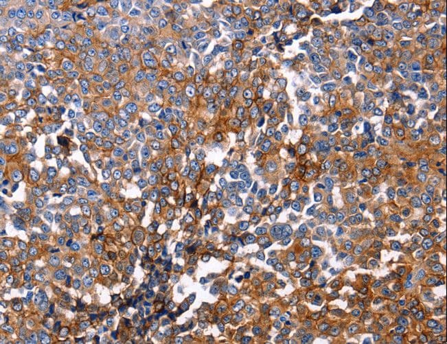 Polyclonal Rabbit anti-Human DUSP6 / MKP3 Antibody (IHC, WB)