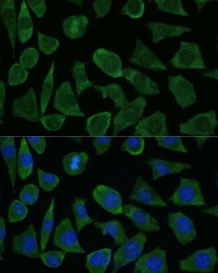 FKBP1B / FKBP12.6 Antibody