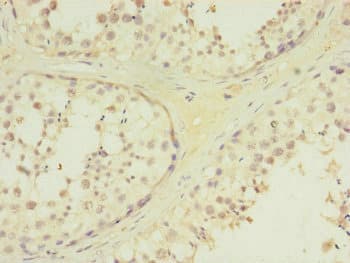 MTERF2 / MTERFD3 Antibody