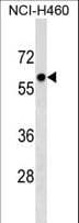 PRIM2 / DNA Primase Antibody (aa317-345)