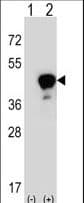 LRG1 / LRG Antibody (aa194-223)