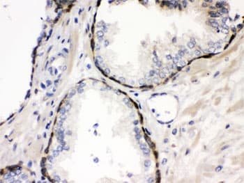 Polyclonal Rabbit anti-Human CSTB / Cystatin B / Stefin B Antibody (IHC, WB)