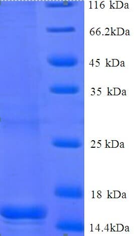 Human BEND3 Protein (Recombinant His)