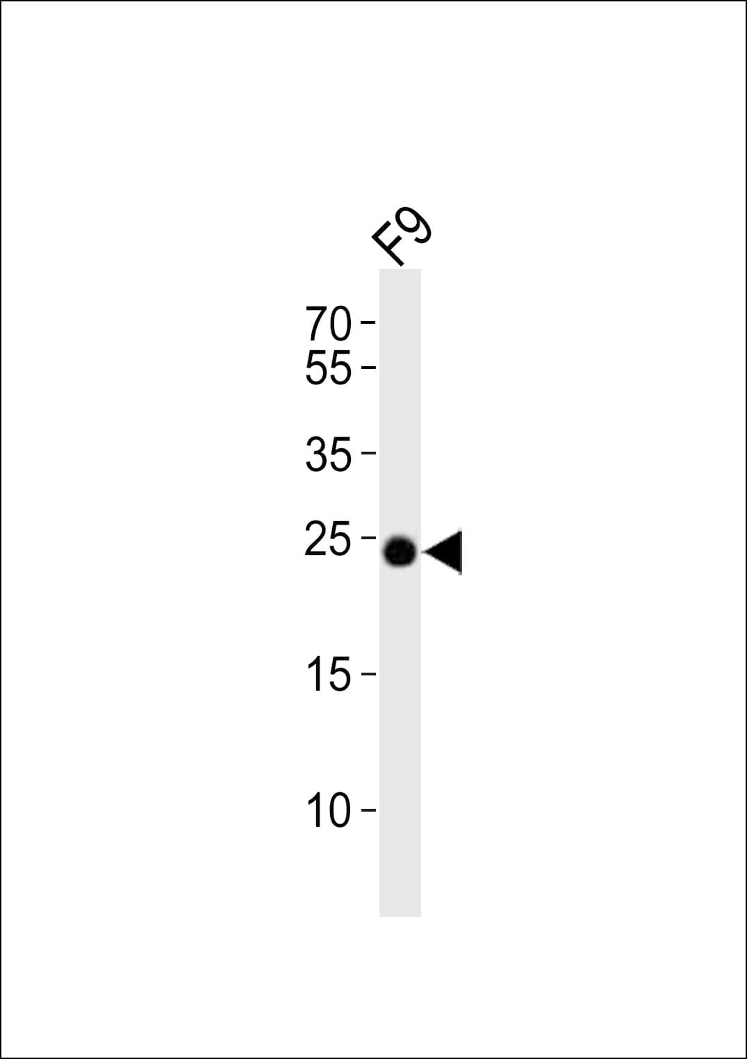ERAS Antibody (aa19-52)
