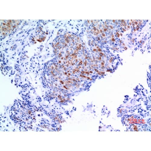 Polyclonal Rabbit anti-Human Pan Cytokeratin Antibody (IHC, WB)