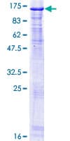 Human NCAPH / CAP-H Protein (Recombinant GST)