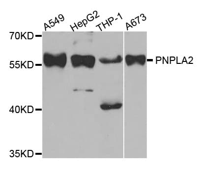 Polyclonal Rabbit anti-Human PNPLA2 / ATGL Antibody (IHC, WB)