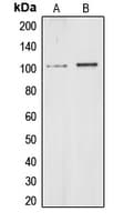 CHD1L Antibody (Internal)