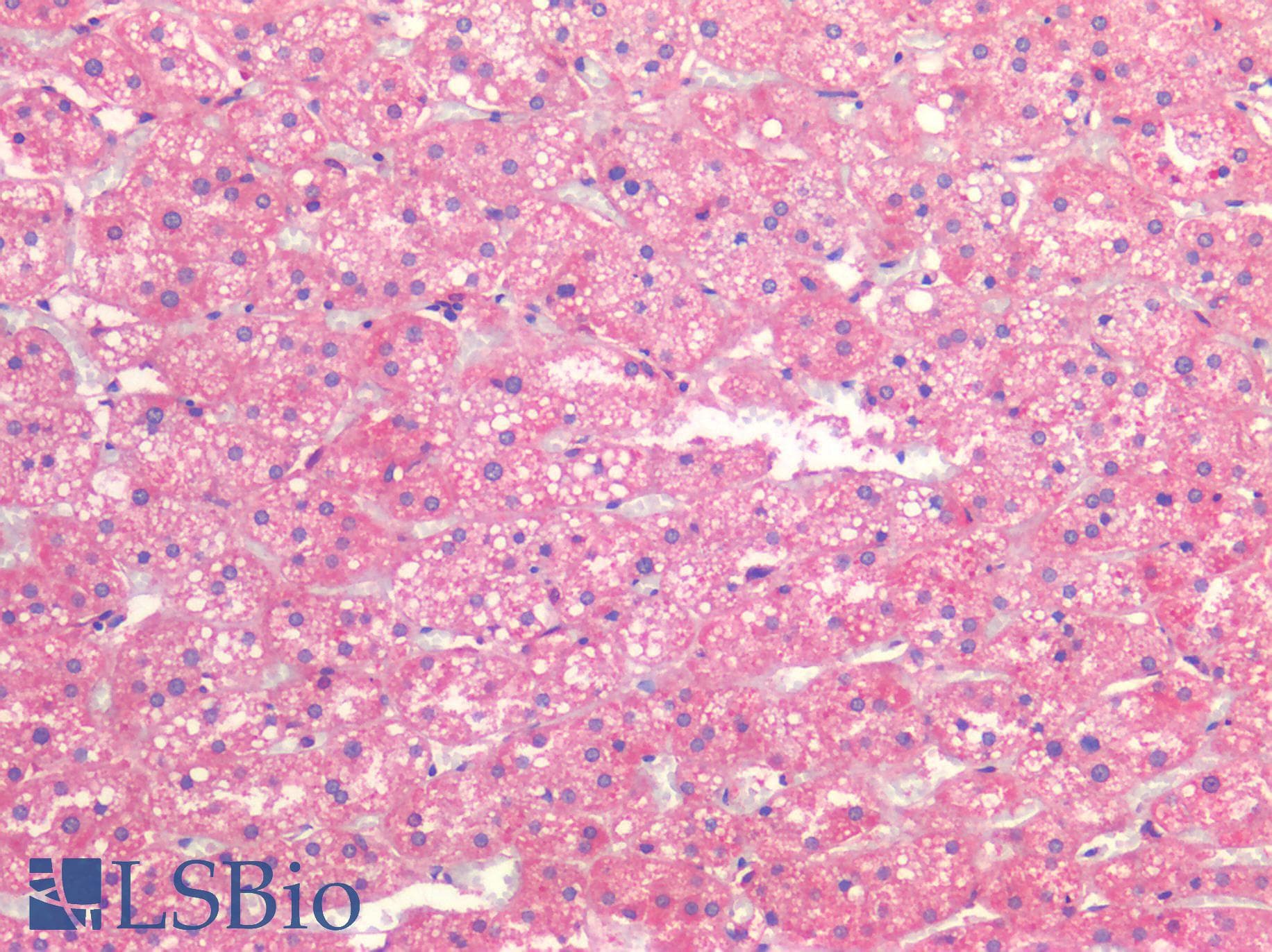 IHC-plus™ ALK2 / ACVR1 Antibody