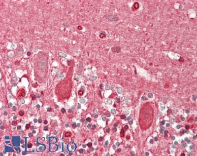 IHC-plus™ Monoclonal Mouse anti-Human SLC2A6 / GLUT6 Antibody (clone 7E3, IHC, IF, WB)