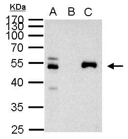 Polyclonal Rabbit anti-Human PAX8 Antibody (aa1-204, IHC, WB)