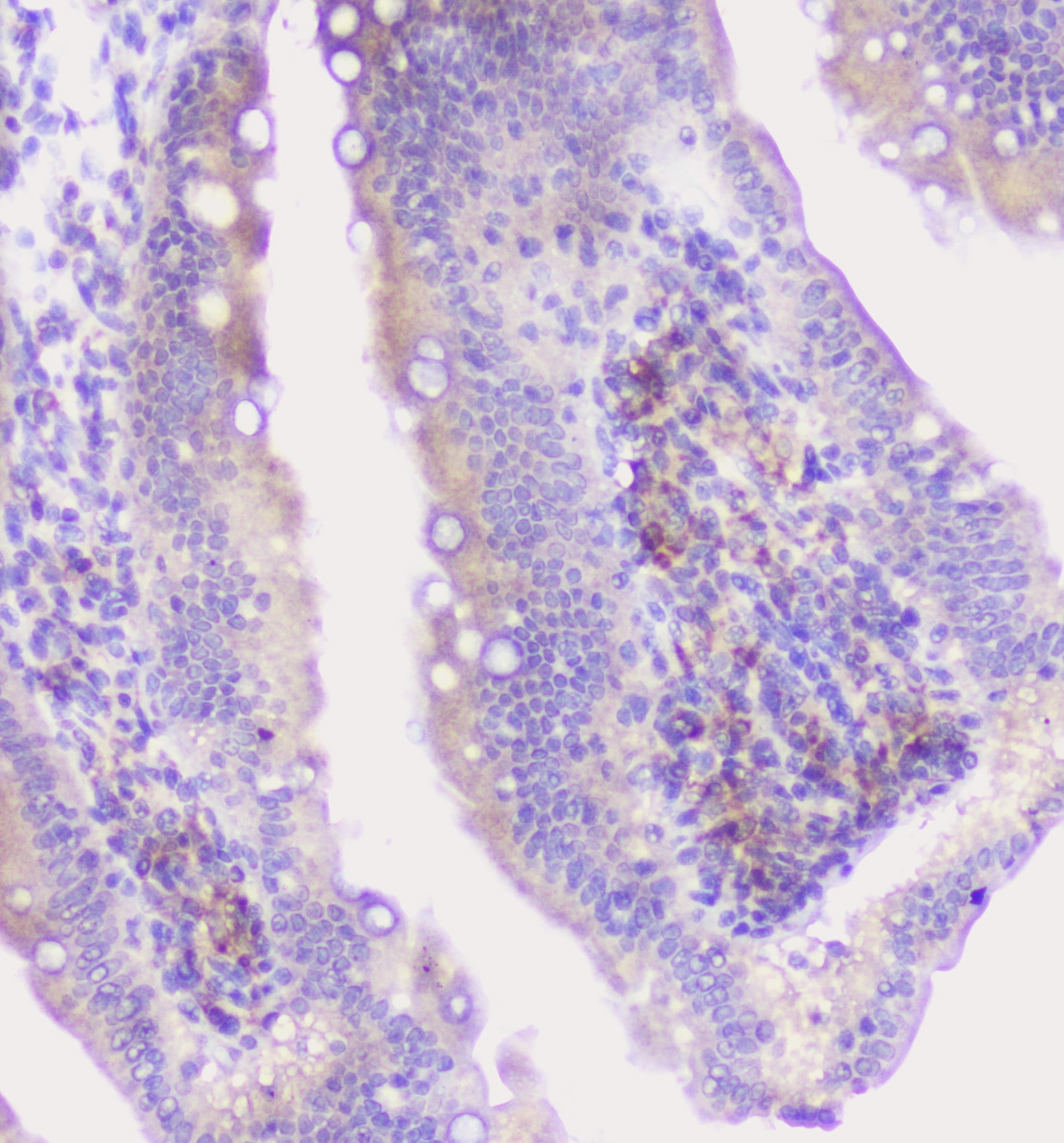 Properdin / CFP Antibody